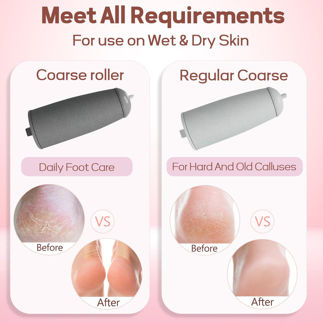Electric Callus Remover for Feet